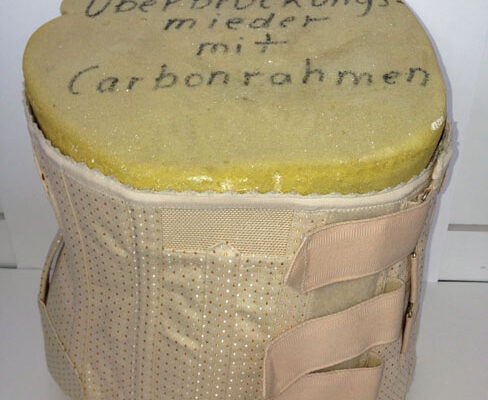 Überbrückungmieder mit Carbonrahmen